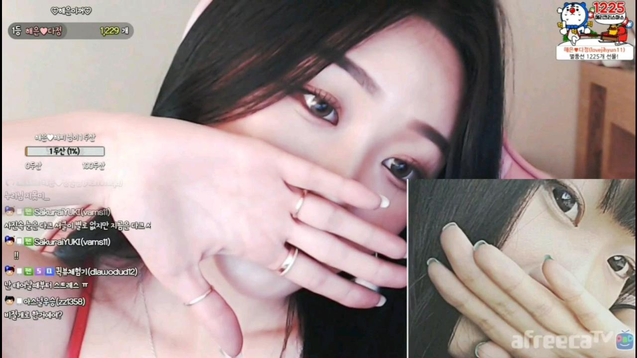 해은 :: 성형시술_전후 3해피 크리스마스
