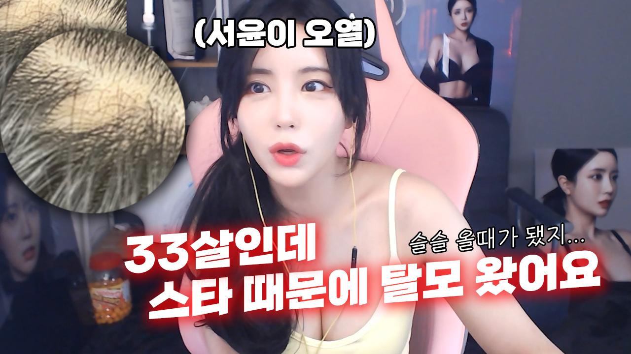 스타에 진심인 존예 여캠에게 생겨버린 그것은? │광고아님